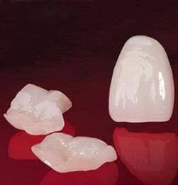 瑞士e.max press全瓷嵌体