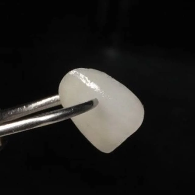 锂瓷贴面（玻璃陶瓷）