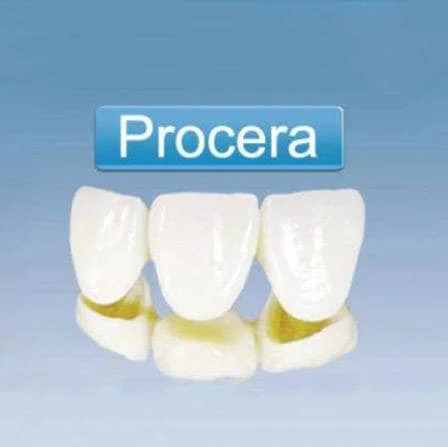 睿典瓷Procera全瓷冠