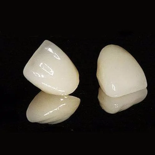 魅影（彩锆）全瓷冠