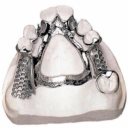 纯钛支架（小）