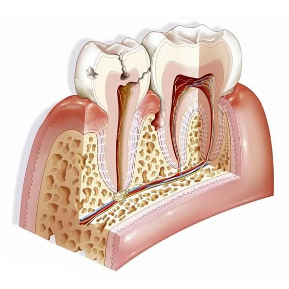 轻中重度牙周治疗