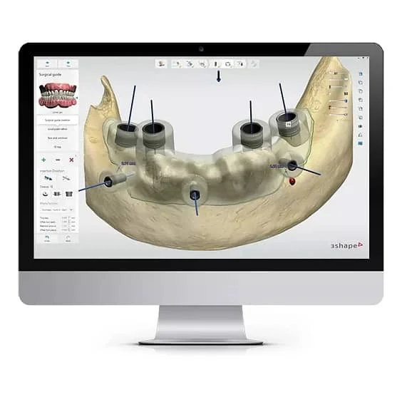 数字化导板技术