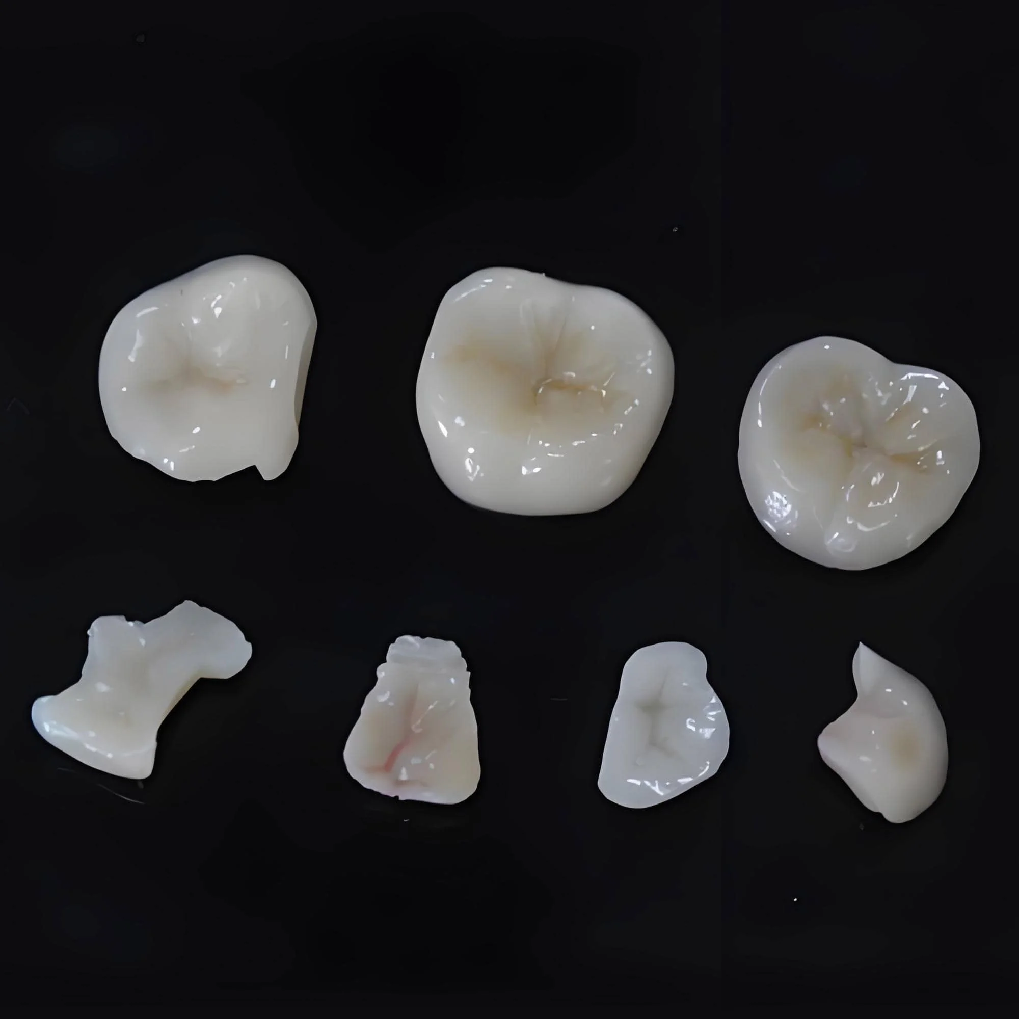 魅影（彩锆）嵌体