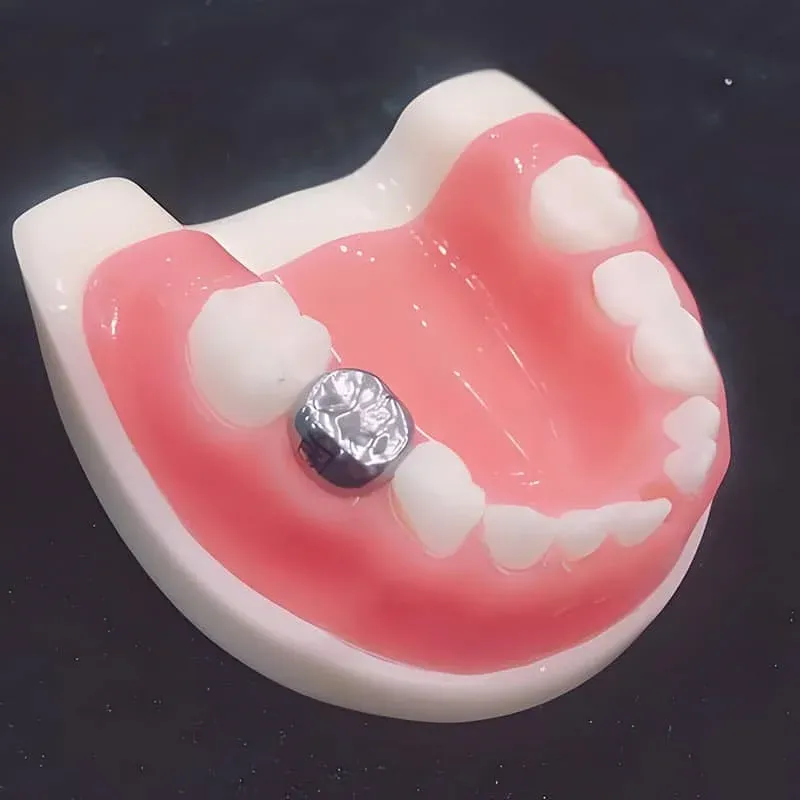 预成冠 - 图片 2