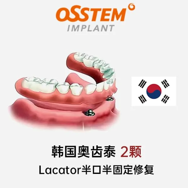 奥齿泰2颗Lacator半口半固定修复