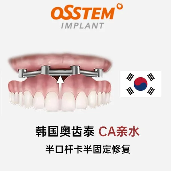 韩国奥齿泰CA亲水半口杆卡半固定修复