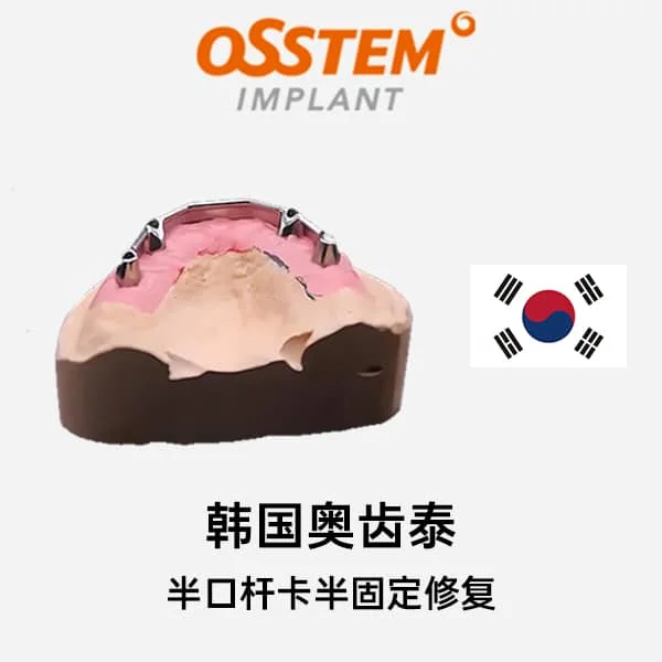 韩国奥齿泰半口杆卡半固定修复