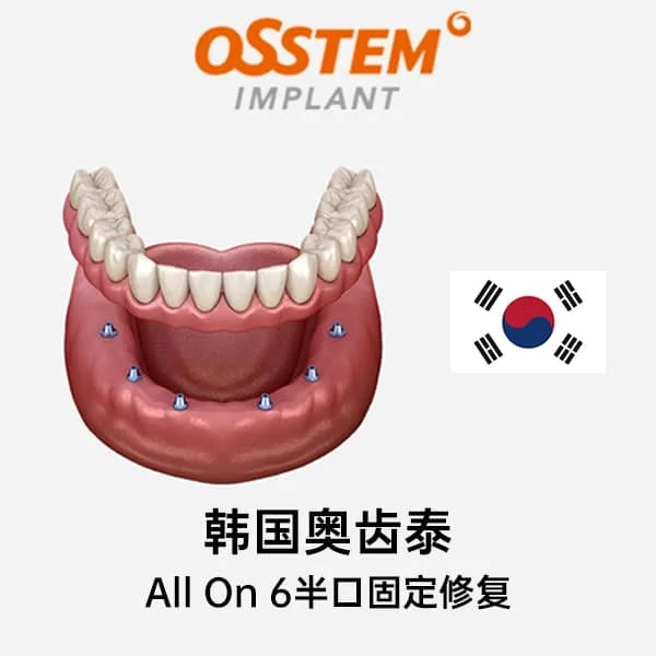 韩国奥齿泰All On 6半口固定修复