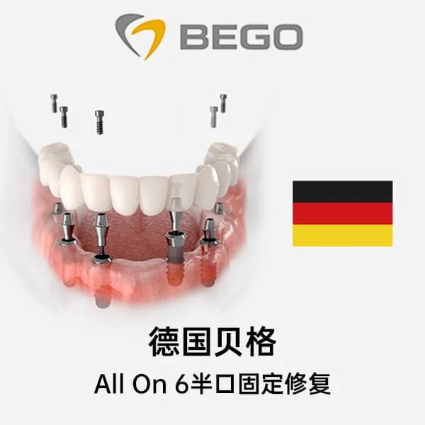 德国贝格All On 6半口固定修复