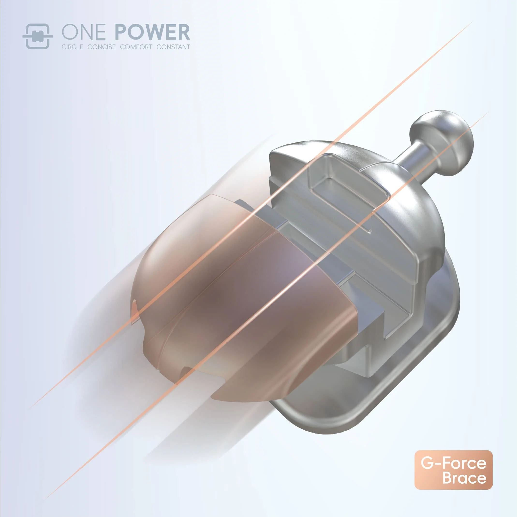 圆形自锁托槽矫正