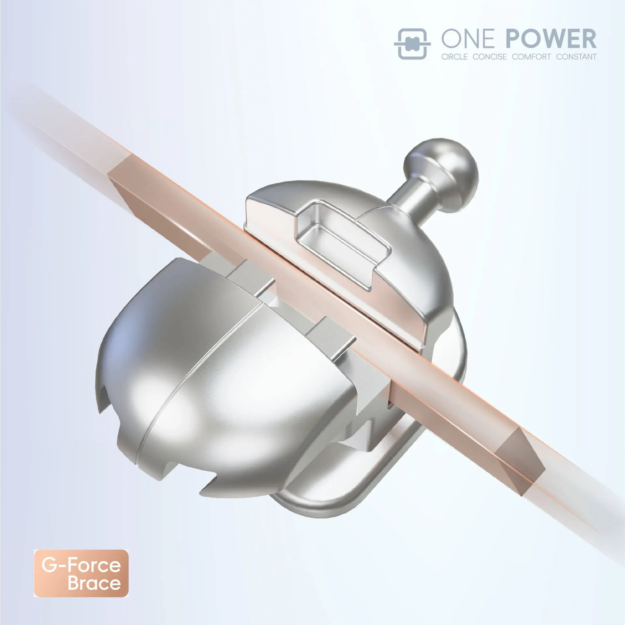 圆形自锁托槽矫正 - 图片 3