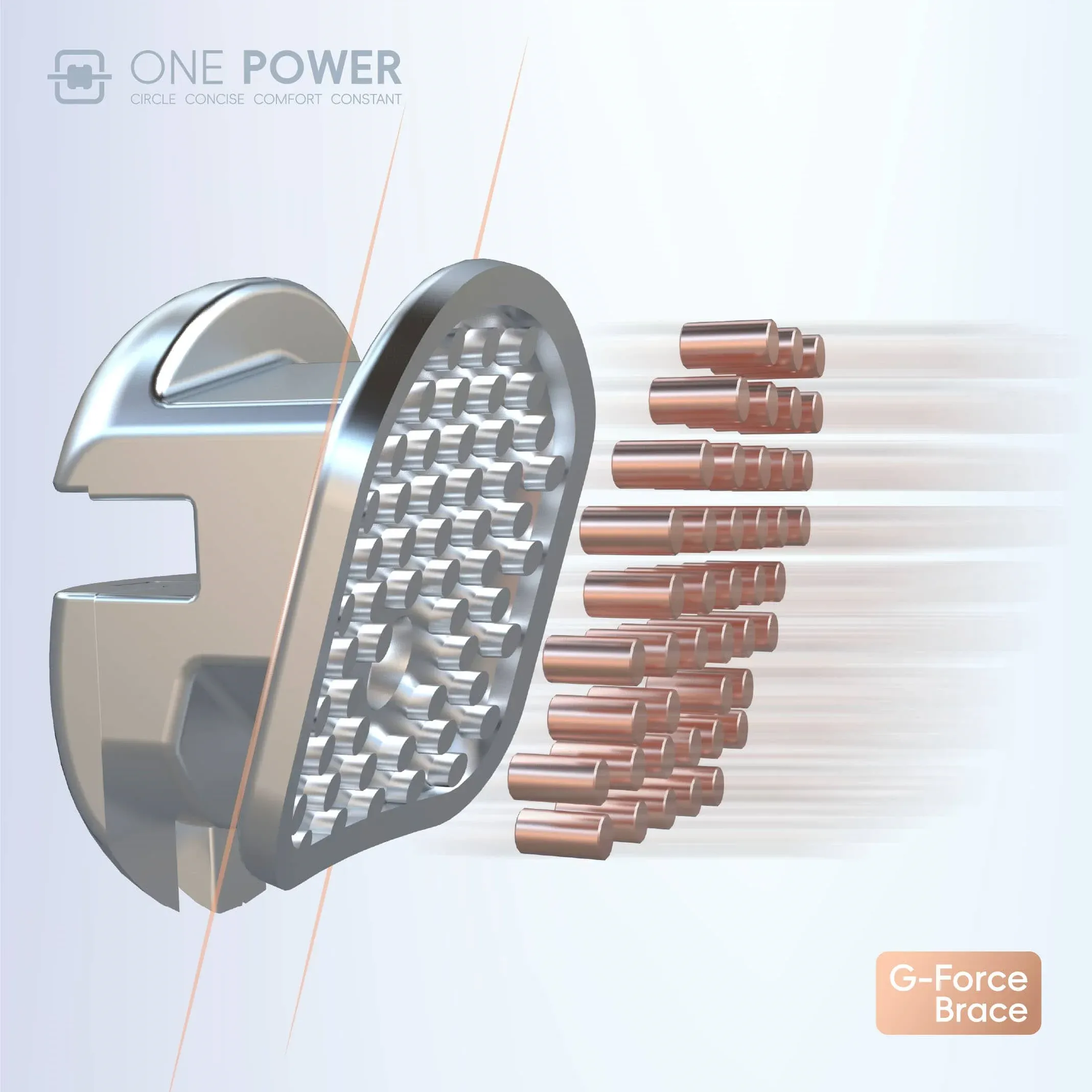 圆形自锁托槽矫正 - 图片 4